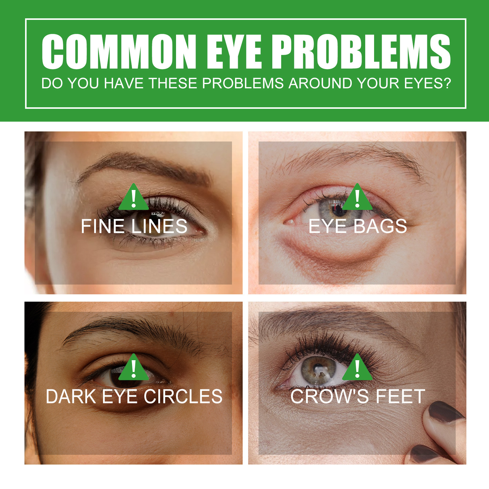(1 PC) Anti Dark Circle Eye Serum Pigment Correction Remove Puffiness Eyes Bag Fades Fine Lines Moisturize Hydrating Nourish Aloe Vera Whitening Eye Essence