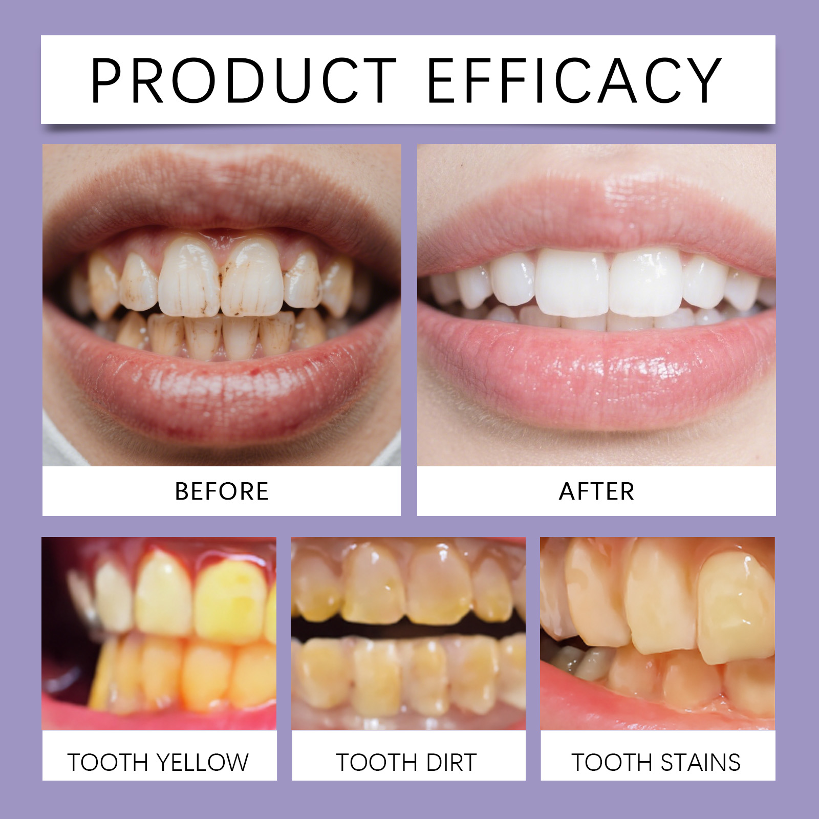 Bee Venom Care Toothpaste Freshens Breath Protects Gums Strengthens Enamel Daily Cleansing Guards Oral Health