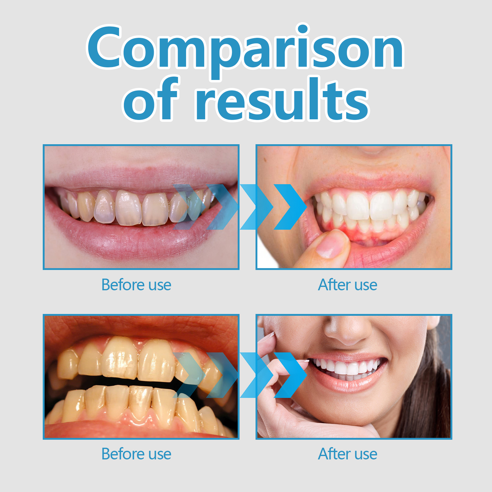 Gum Care Gel Pen Oral Hygiene Stain Remover For Teeth And Gum Health Daily Protective Treatment