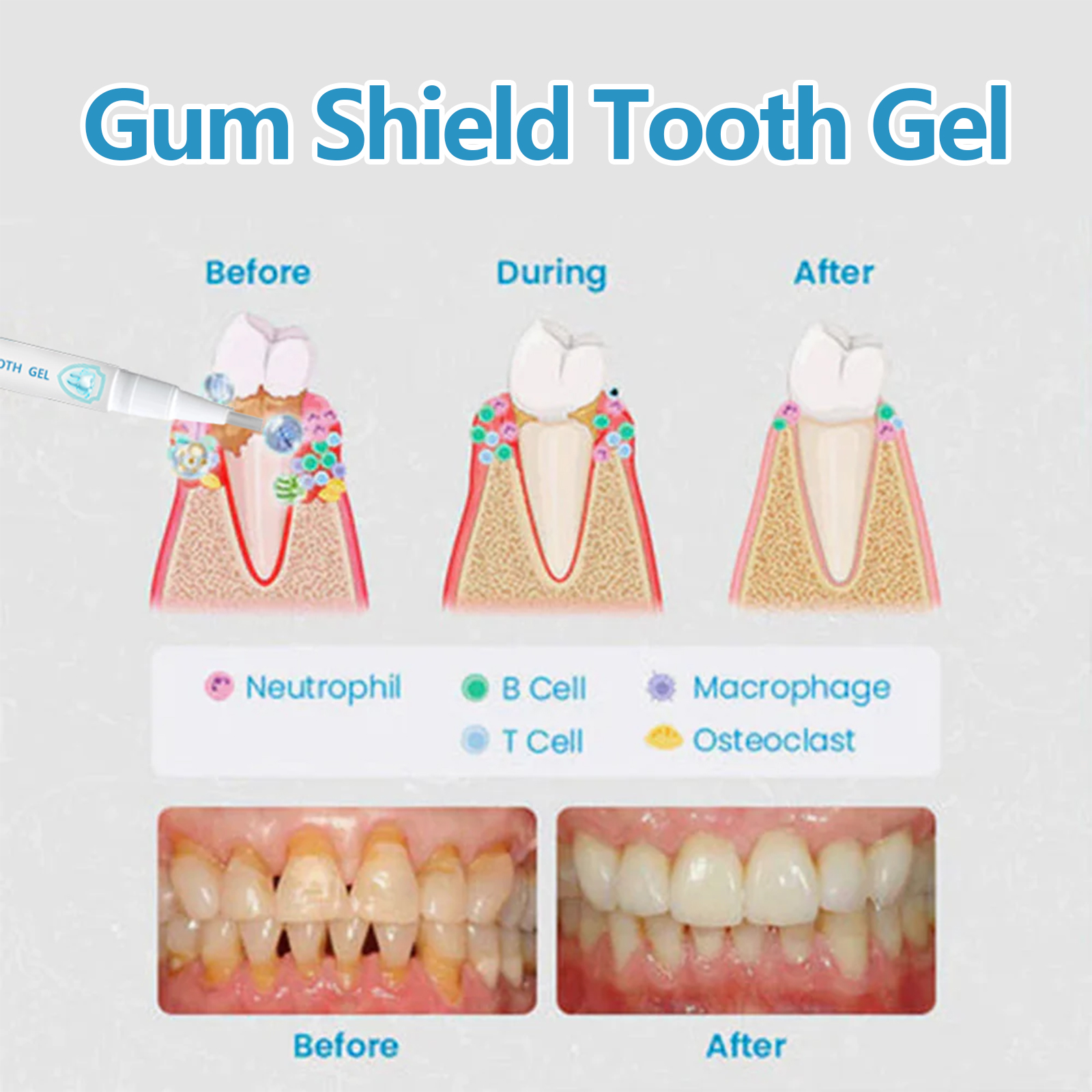 Gum Care Gel Pen Oral Hygiene Stain Remover For Teeth And Gum Health Daily Protective Treatment