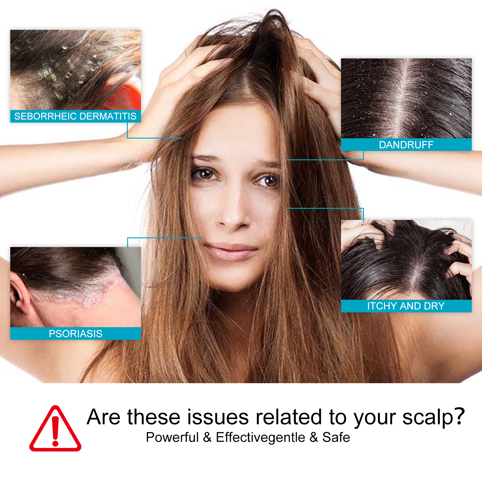 Anti Dandruff Scalp Soothing Shampoo Deep Cleansing For Itchy Scalp Flaking And Hair Strength Daily Care 1 PCS