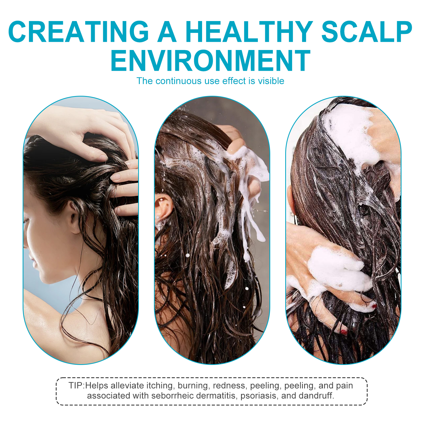 Anti Dandruff Scalp Soothing Shampoo Deep Cleansing For Itchy Scalp Flaking And Hair Strength Daily Care 1 PCS