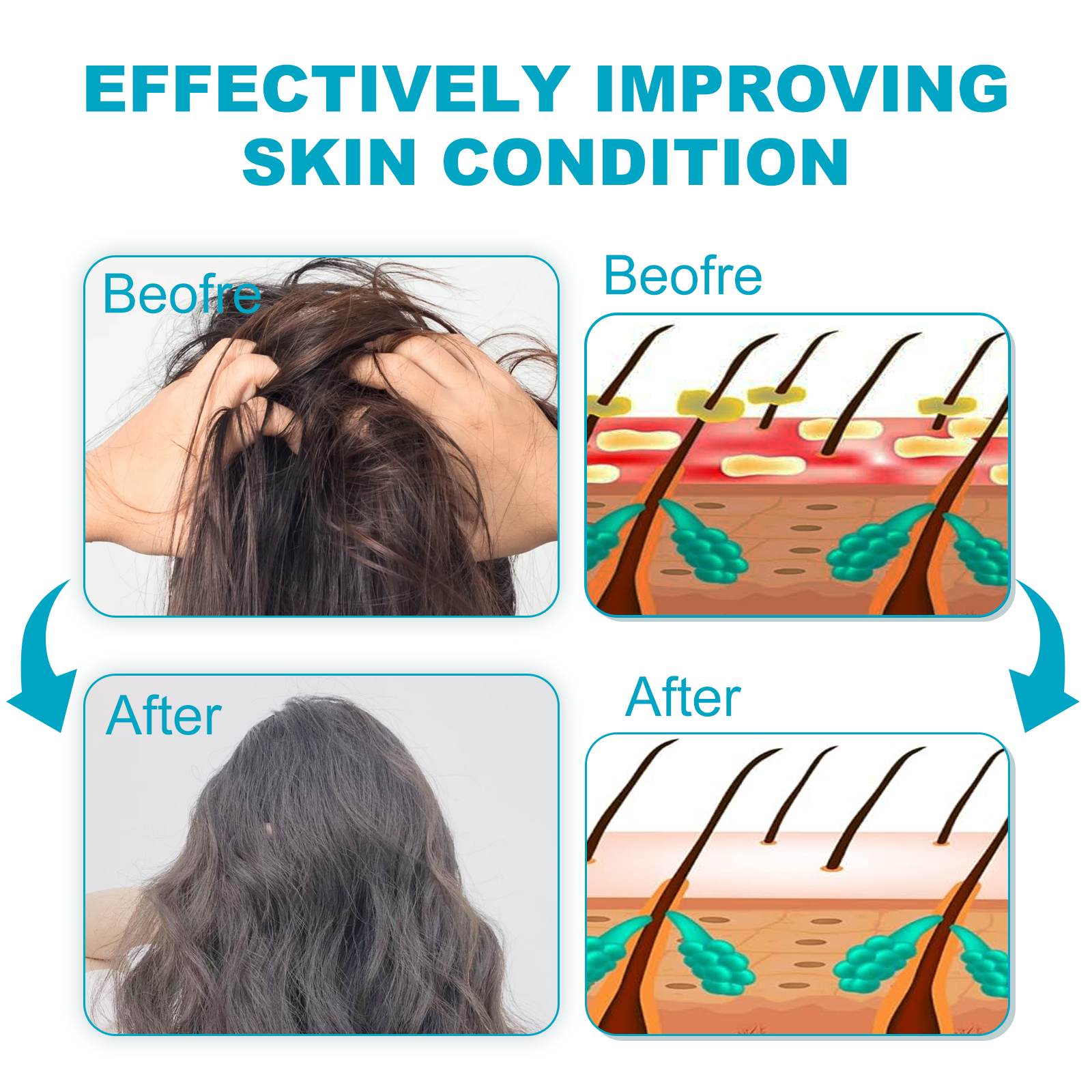 Anti Dandruff Scalp Soothing Shampoo Deep Cleansing For Itchy Scalp Flaking And Hair Strength Daily Care 1 PCS