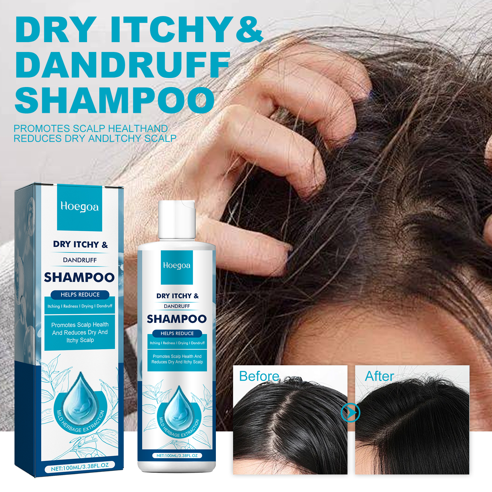 Anti Dandruff Scalp Soothing Shampoo Deep Cleansing For Itchy Scalp Flaking And Hair Strength Daily Care 1 PCS