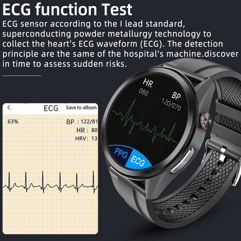 Smart Watch AI Intelligent Analysis ECG Report PPG Remote Care Fitness Bracelet