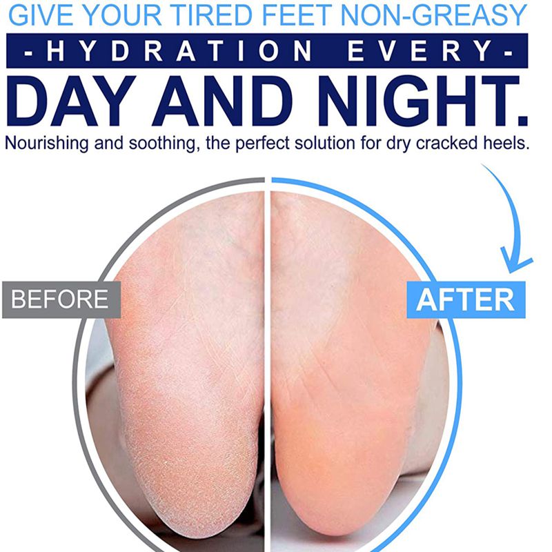 Foot Cream Hand Foot Anti Cracked Foot Mask Dry Foot Repair Cream Cracked Heel Removal Dead Skin Feet Care
