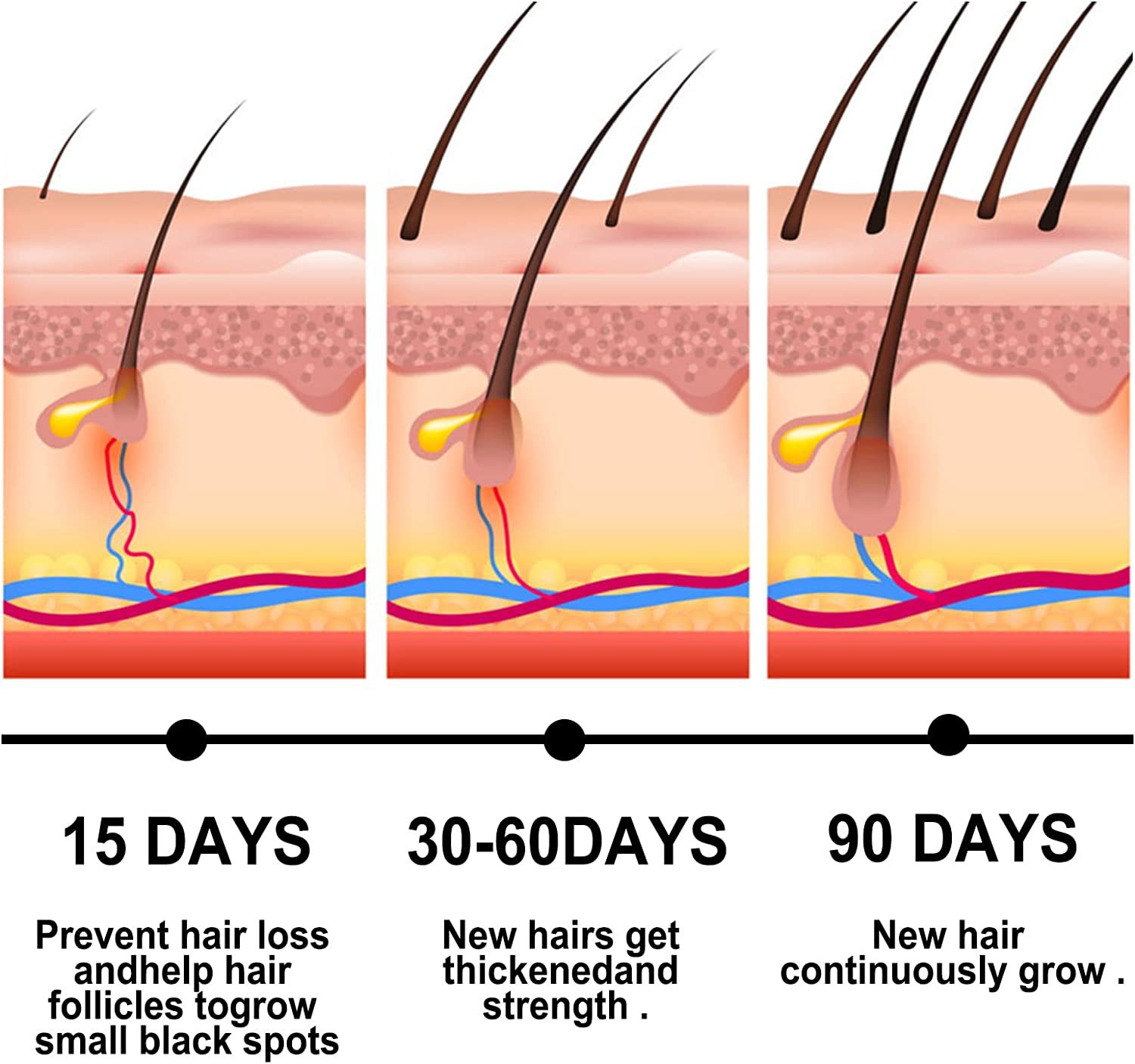 iBeaLee Anti-Hair Loss Spray Hair Growth Serum Tonic Deep Moisturize Repair Strengthen Hair Root Serum Anti-Frizz Care Scalp Nourish 20ml