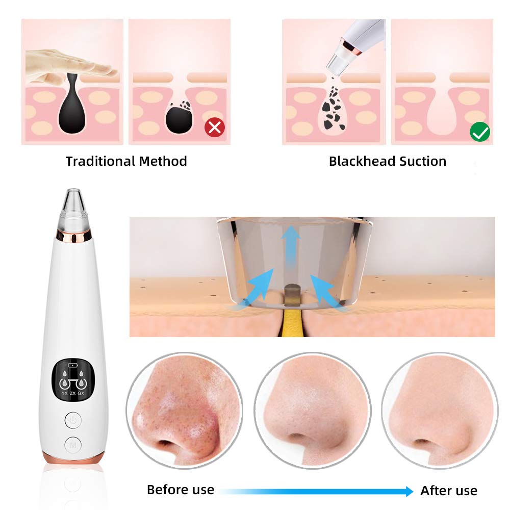 Blackhead Remover Tool Kit Skin Care Facial Blackhead Remover Electric Acne Cleaner Vacuum Tool Black Spots Pore Face Deep Cleaning Machine