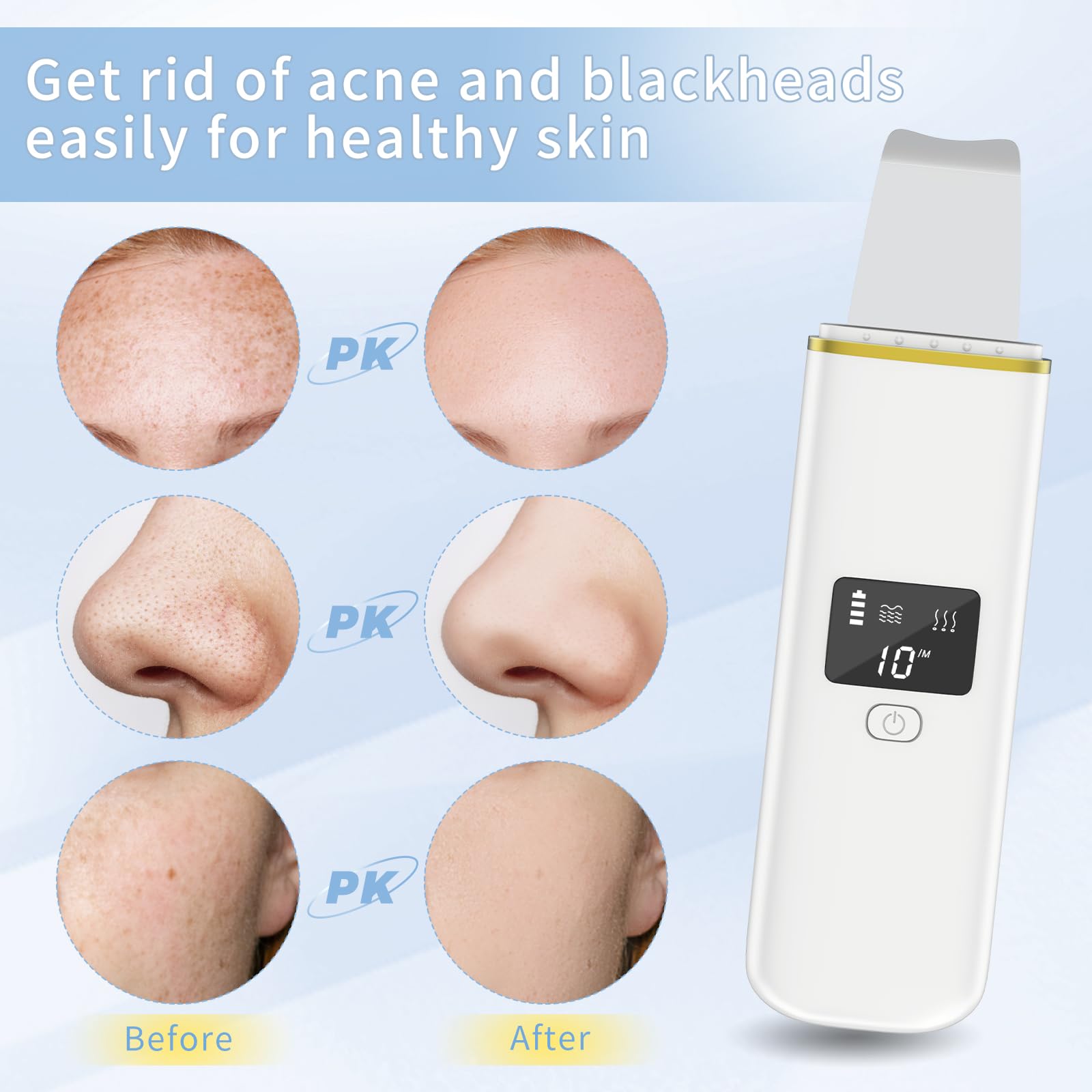 Ultrasonic Skin Scrubber Facial Skin Scrubber Electric Skin Spatula for Deep Cleaning Blackhead Pores Removal Skin Care LCD Display USB Rechargeable