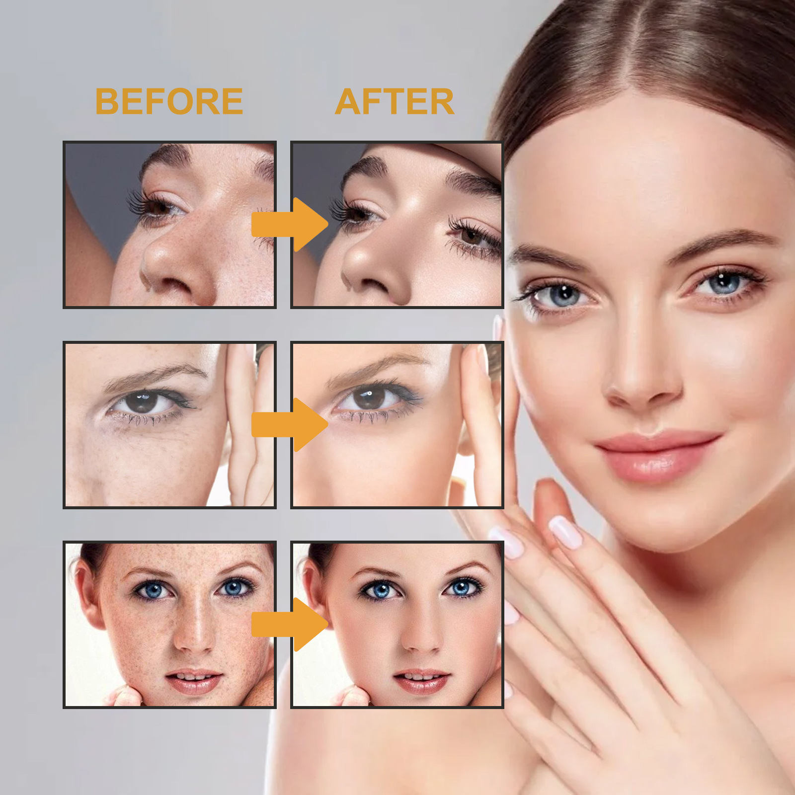 Brightening Face Cream Freckl-e Removal Lightening Dullness Fade D-ark S-pot C-hloasma Skin Firming Moisturizing M-elasma Cream