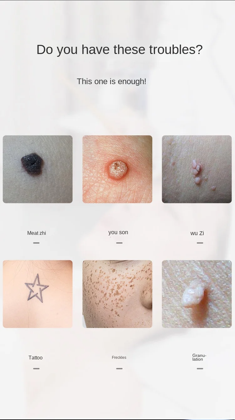 Mole Removal Pen Beauty Salon Special Laser Spot Removal Mole Removal Instrument No Scar Spot Machine Tattoo Eyebrow Washing
