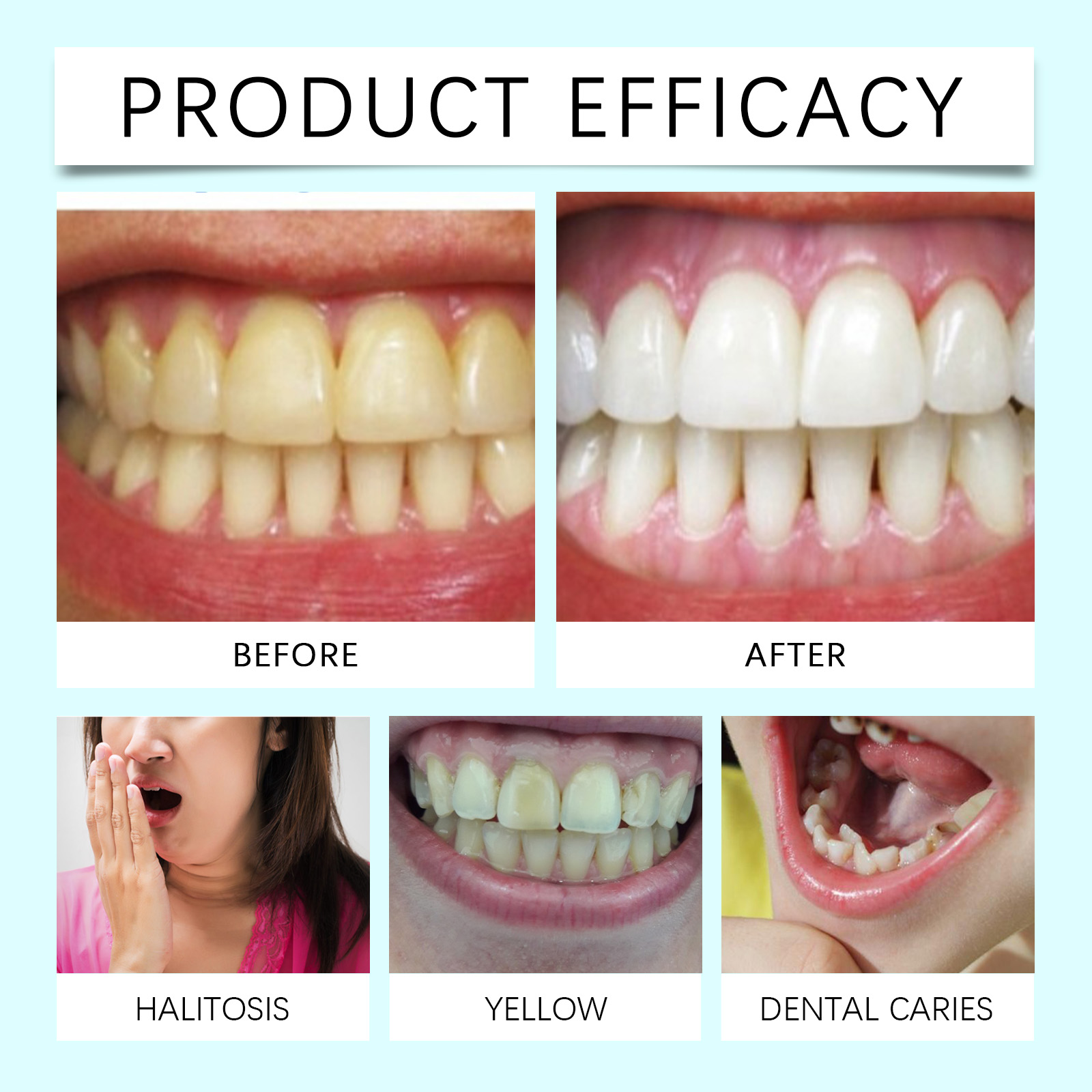 Teeth Strips With Mild Ingredients Clean Tooth Stains Naturally Brighten Freshen Oral Care