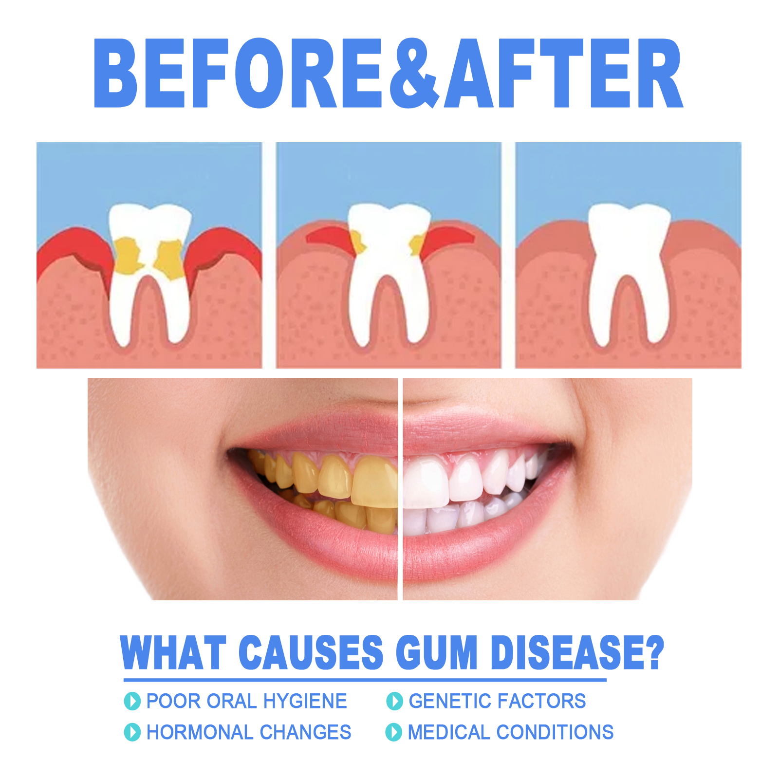 Gum Repair Care Gel Strengthen Gums Reduce Recession Freshen Breath