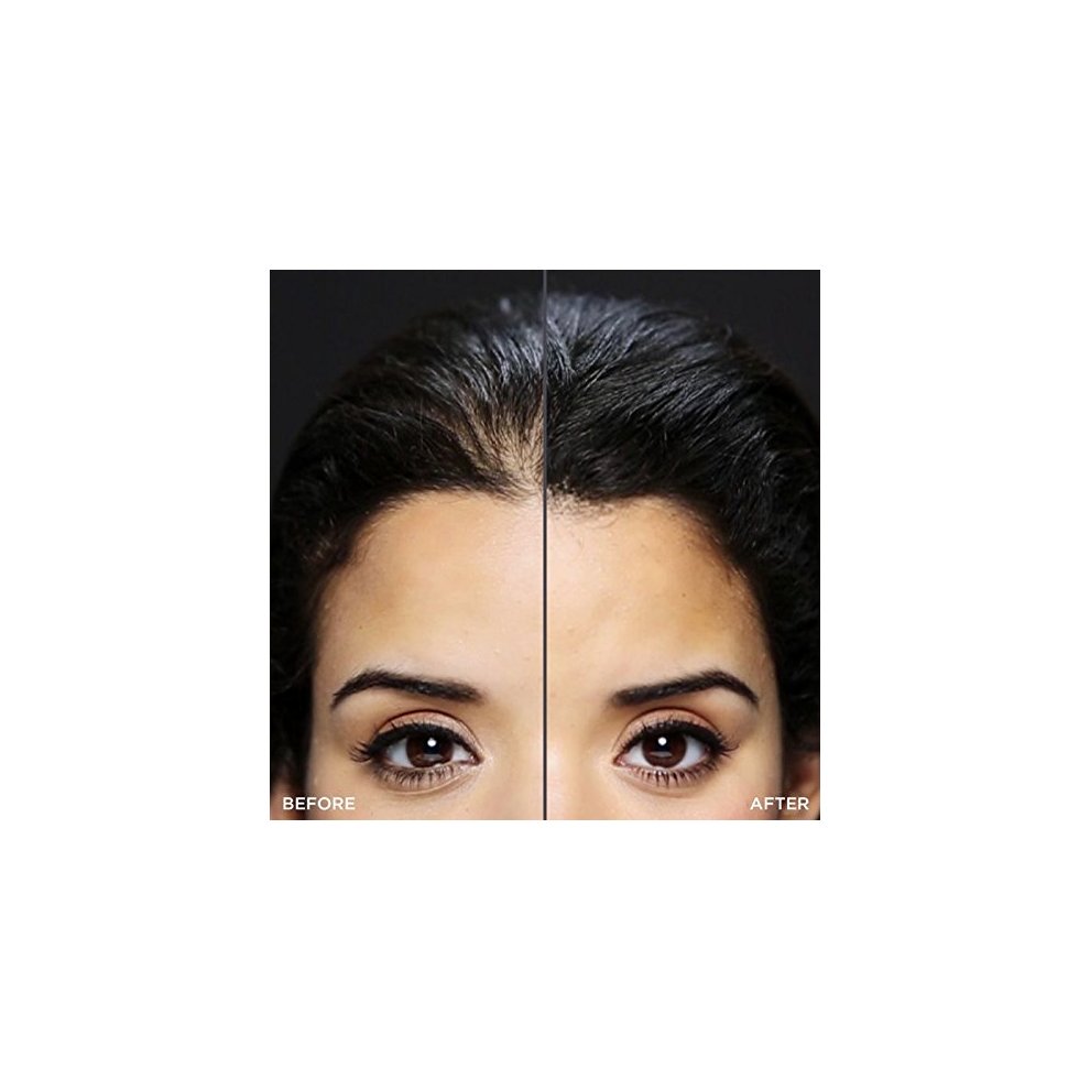 Toppik - Hairline Optimizer