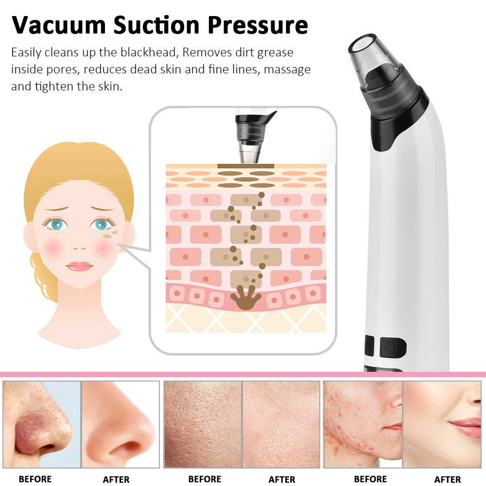 Electric Blackhead Remover Blackhead Suction Instrument Pore Cleaning Device Face Skin Care Tool Hot Compress USB Charging LED Screen