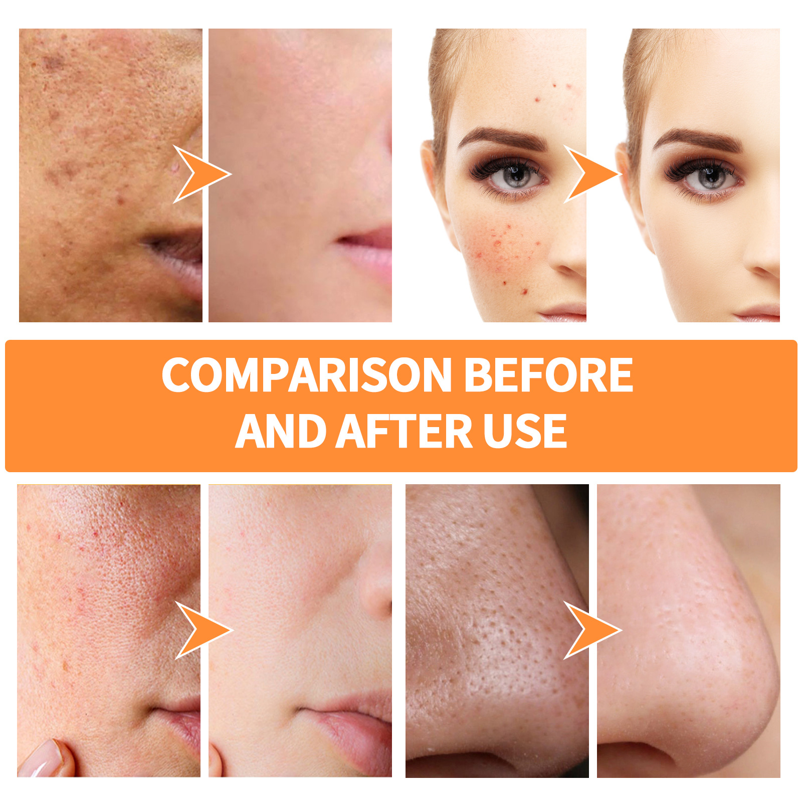 Organic Turmeric Face Mask Stick Deep Cleaning Shrink Pores Hydration Moisturizer Blackhead Remover Acne Scars Reduction Exfoliating Facial Care Mask.