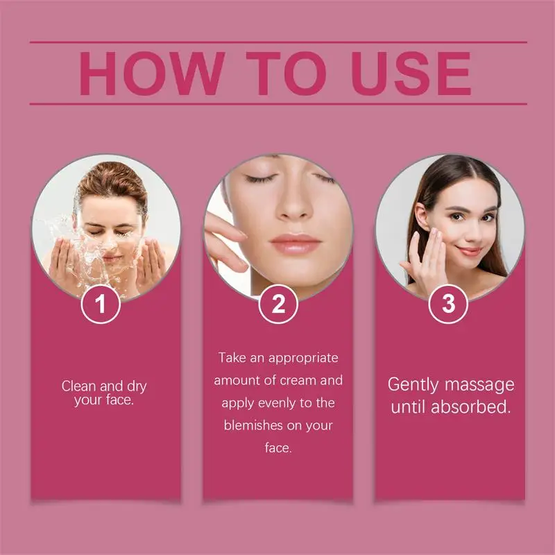EELHOE Cream Nicotinamide Moisturizes Cream Whiten Freckle Cream Melasma Dark Spots Pigmentation Removal Fade Stain Melanin Repair Brighten Face Skin Care