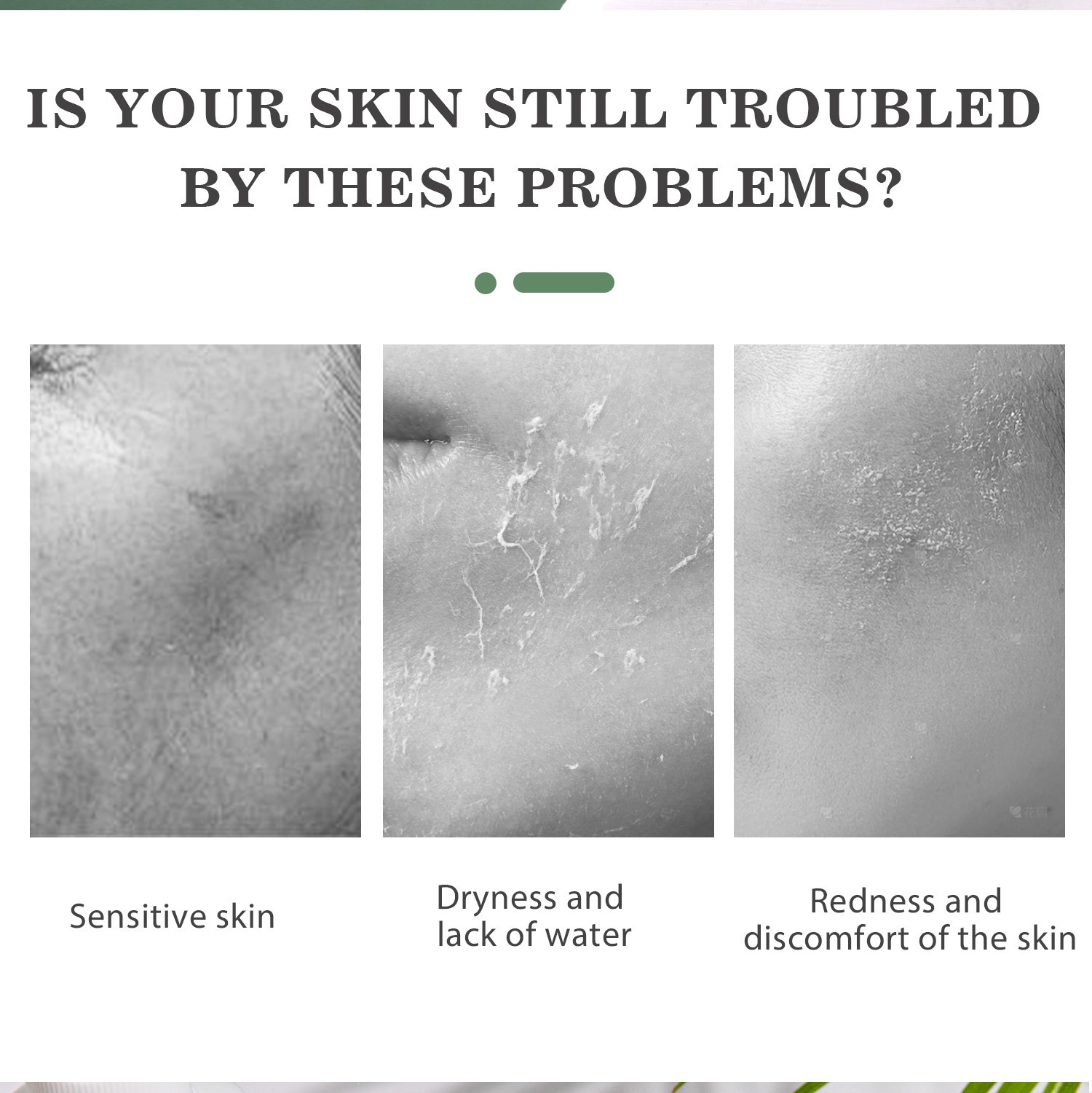 Hypochlorous Acid Facial Spray High Moisture Hydrating Essence For Daily Refreshing Soothing And Balancing Skin Care