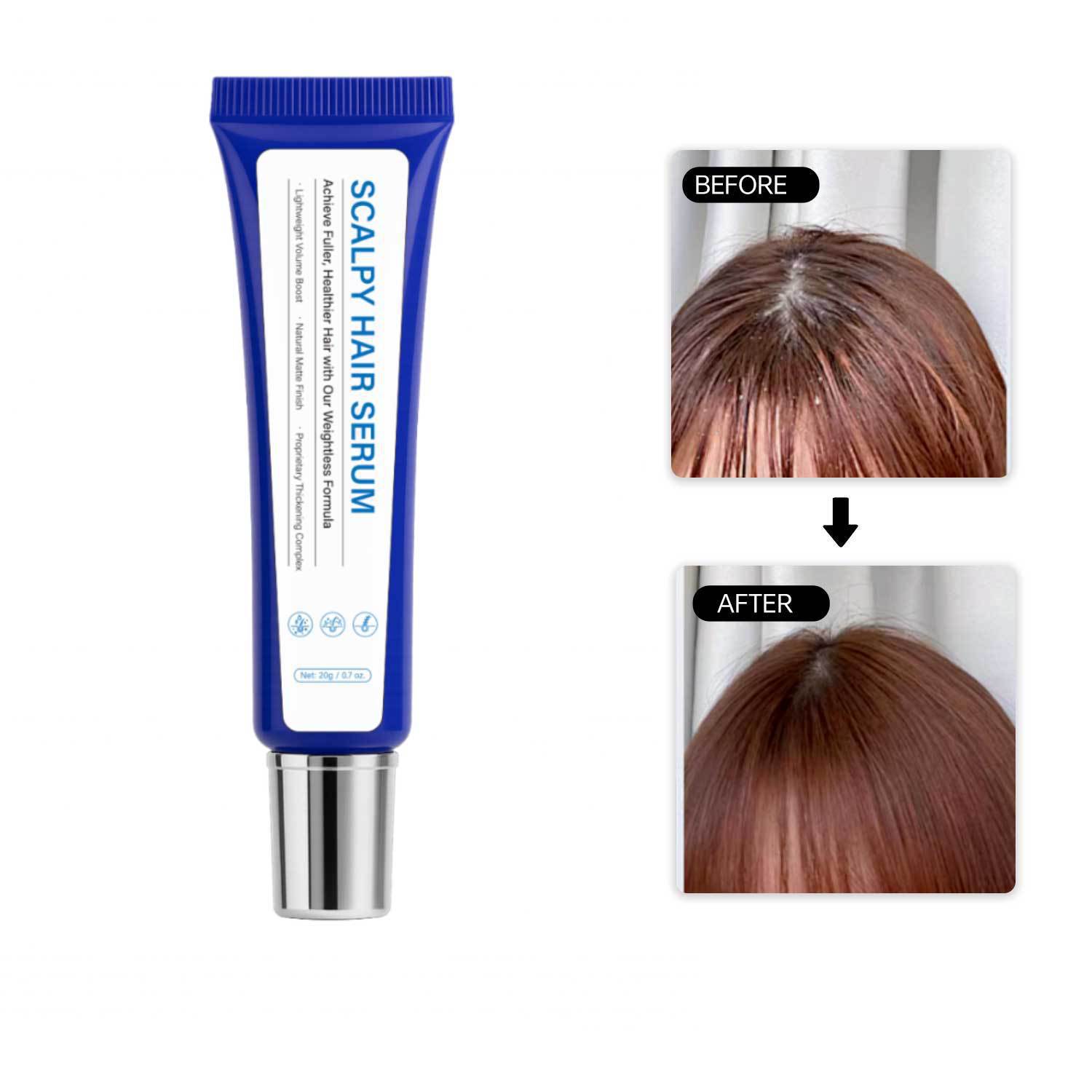 Scalp Hair Serum Nourishing Strengthening Revitalizing For Dry Scalp Thinning Hair Daily Root And Follicle Care Treatment 20g
