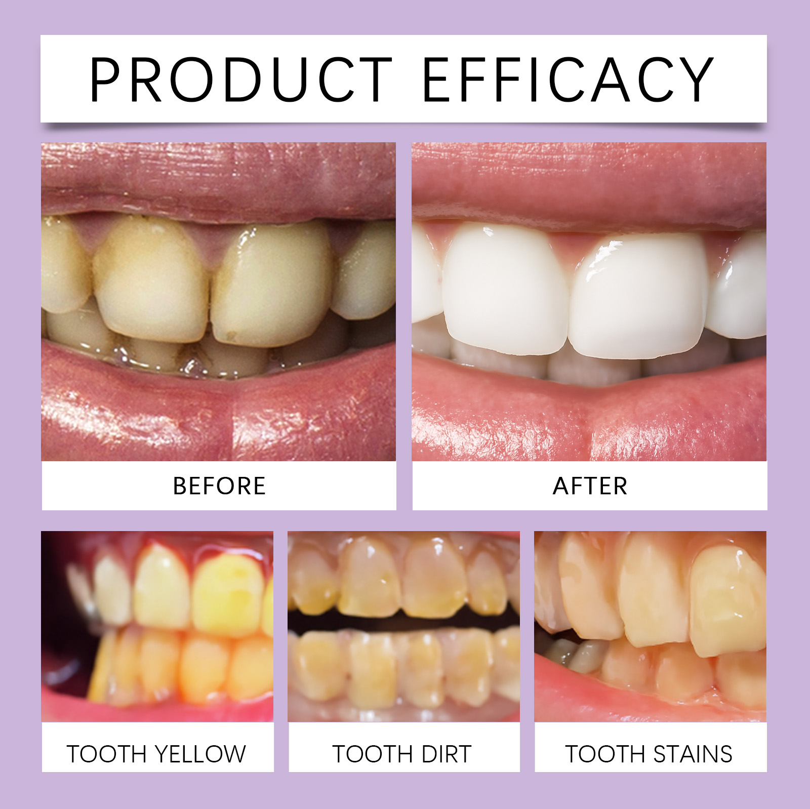 Teeth Cleaning Mousse Mild Dense Foam Care Clean Fresh Comfort Oral Tooth Cleansing Care