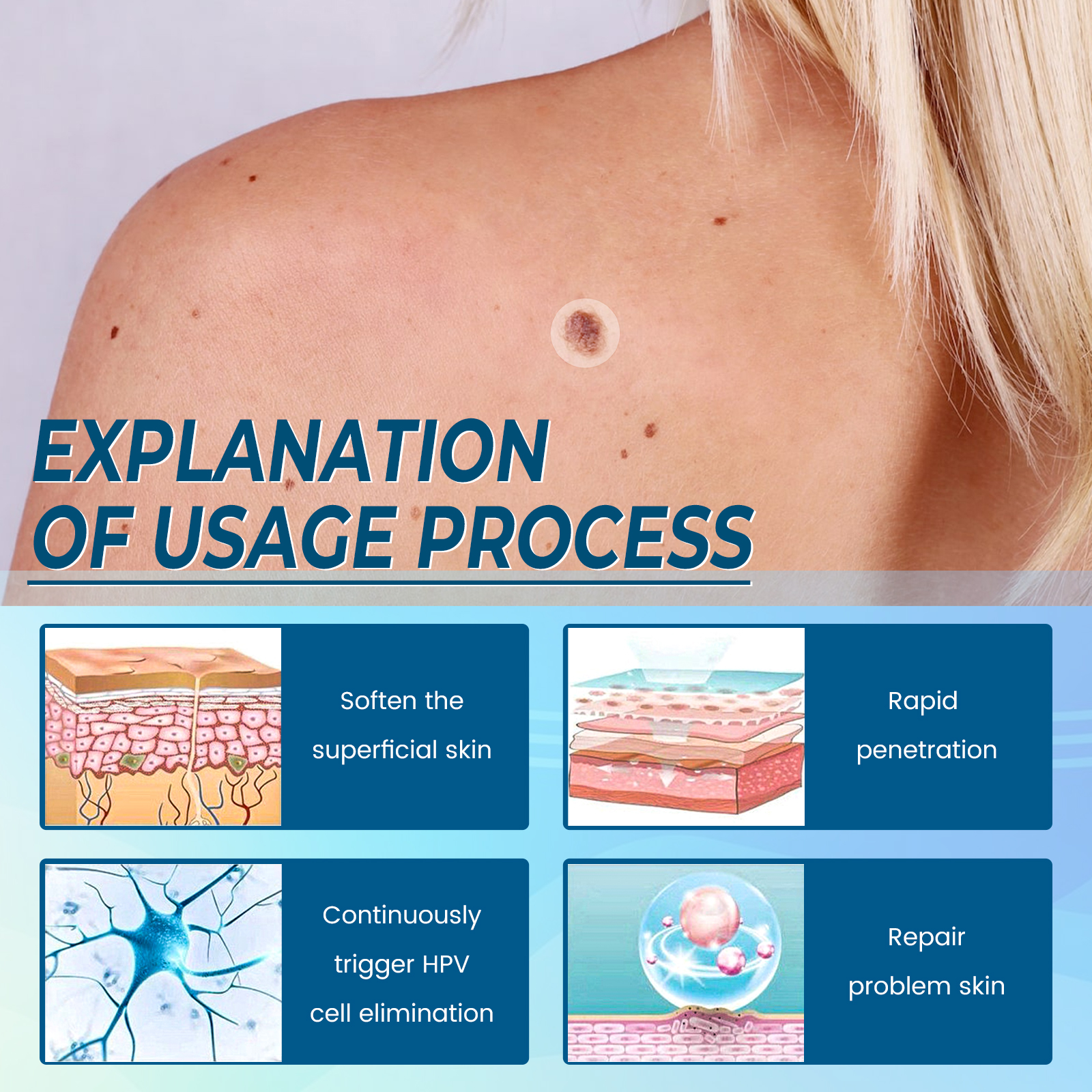 Skin Tag Remover Patch For Moles Warts Corns And Skin Imperfections Gentle Exfoliating Daily Care Treatment