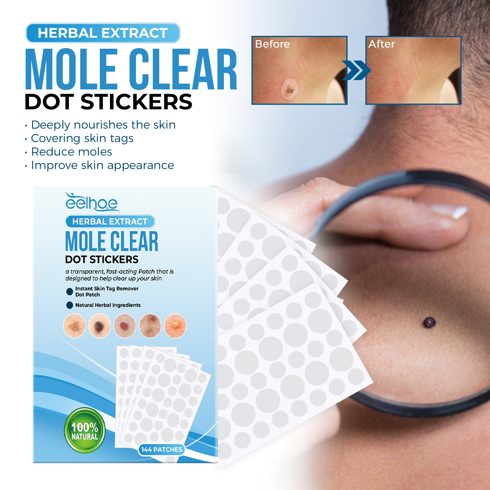 Skin Tag Remover Patch For Moles Warts Corns And Skin Imperfections Gentle Exfoliating Daily Care Treatment