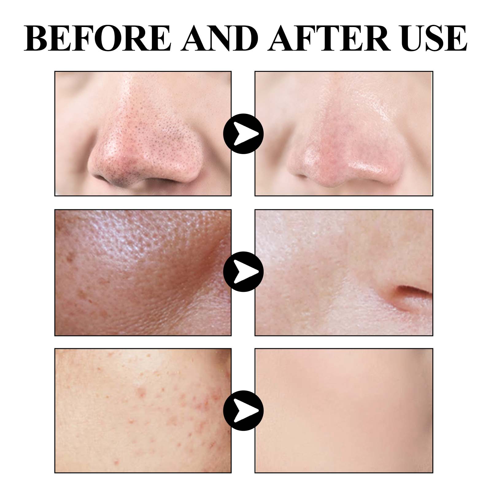 Blackhead Cleansing Clay Mask Deep Pore Cleaning Oil Control Purifying For Daily Face Care 40g