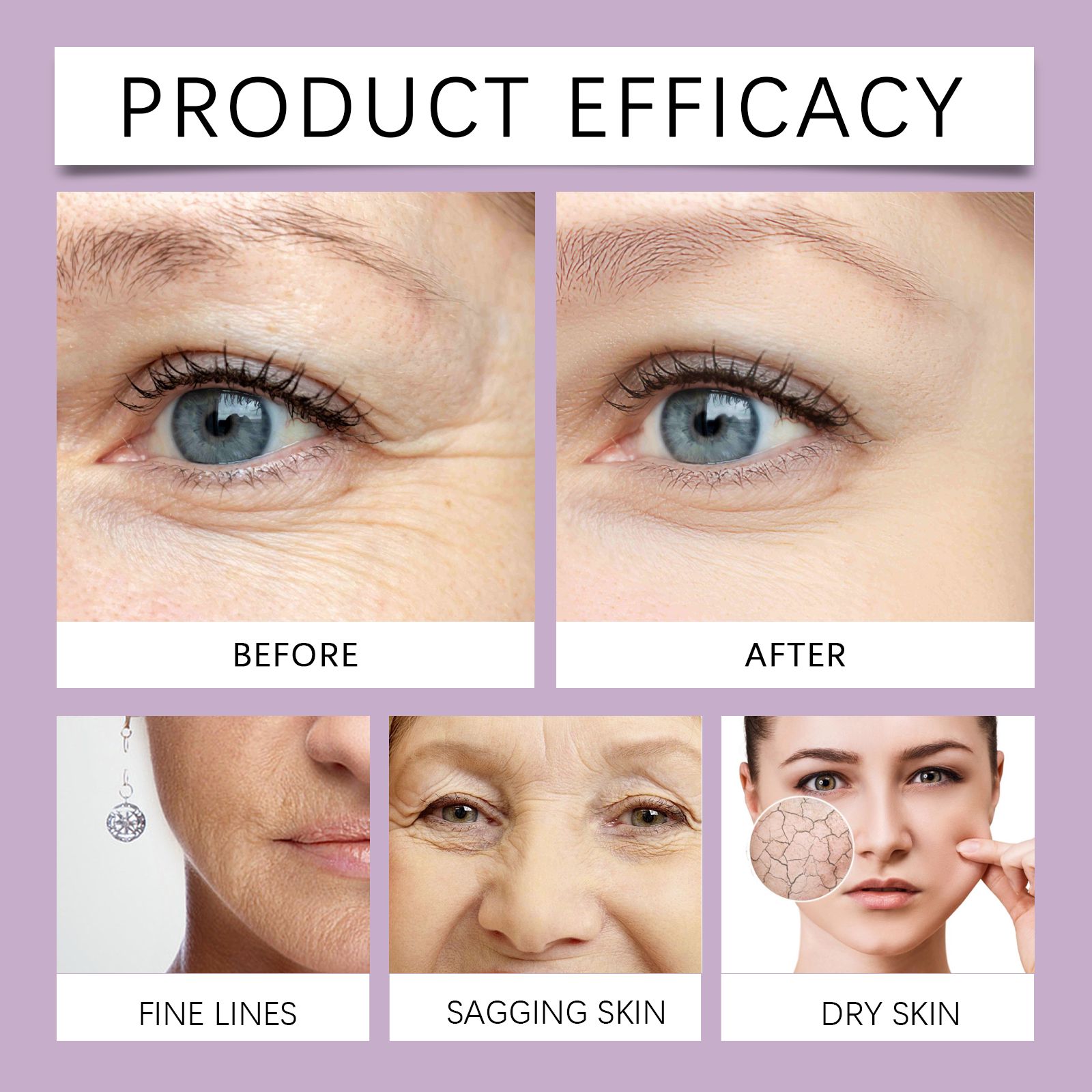 Retinol Anti Wrinkle Serum Hydrating Firming Fine Lines Smoothing For Daily Face Care