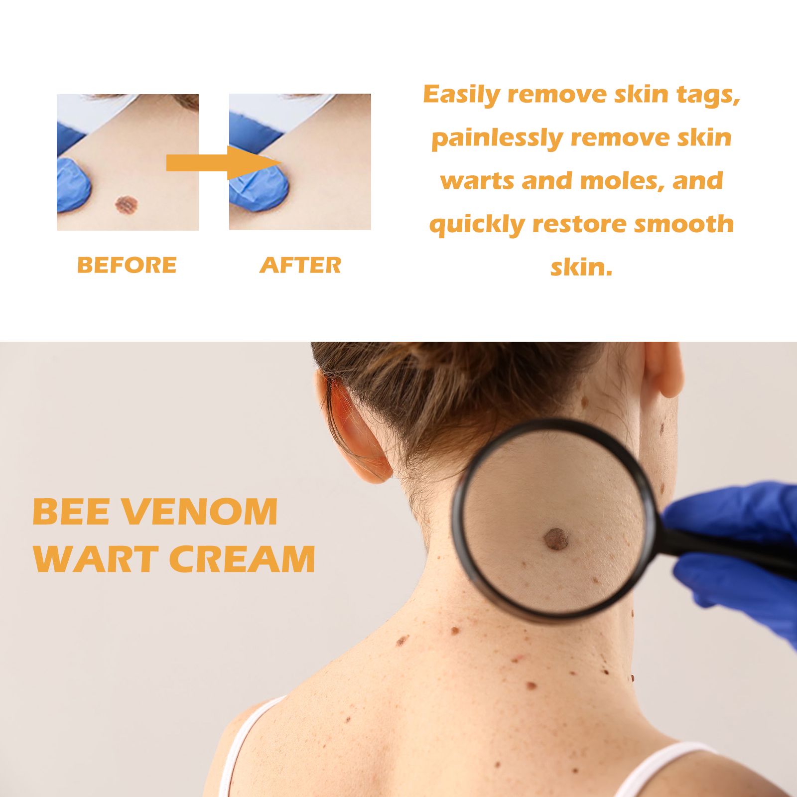Bee Venom Skin Tag And Wart Care Balm For Smoothing And Daily Skin Care