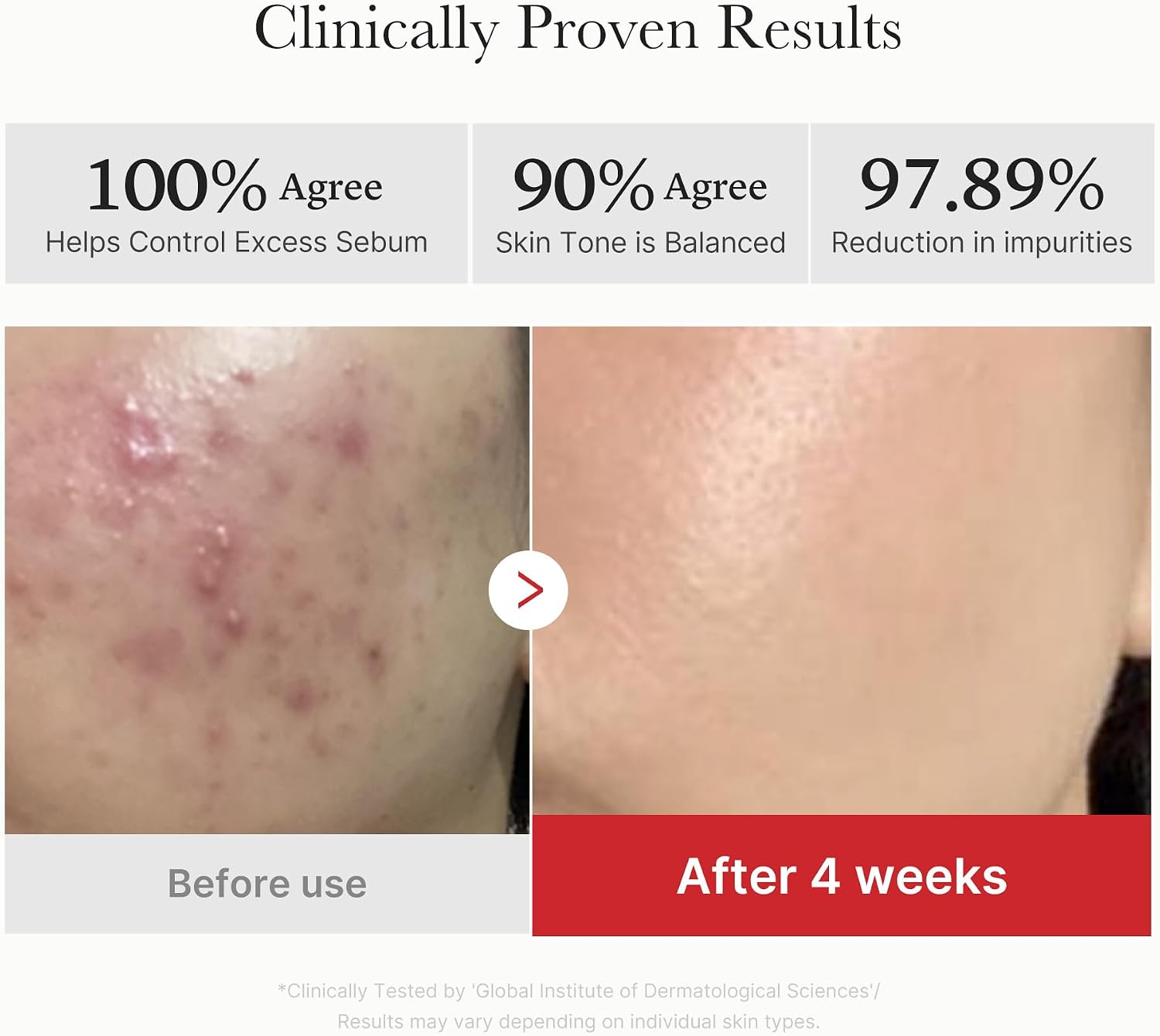 medicube Clarifying Pad Soothing Cream Duo Red Succinic Acid Pad and 3H Daily Moisturizer Gentle Exfoliation Clearer Radiant Skin Balance Comfort Care Routine