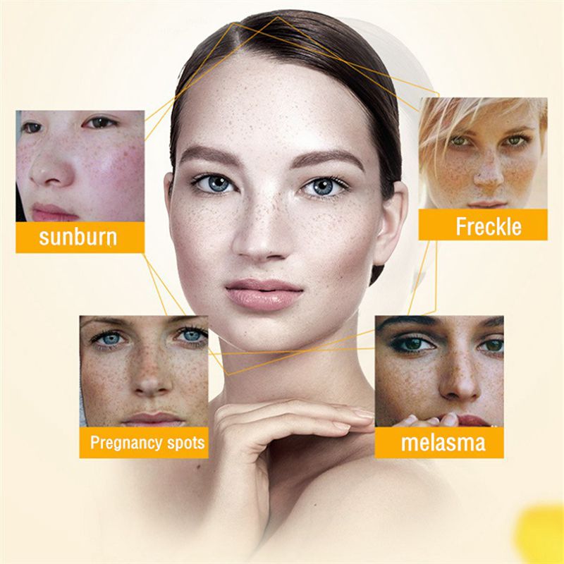 iBeaLee Whitening Freckle Cream Remove Melasma Dark Spots Cream Anti-Aging 20ml