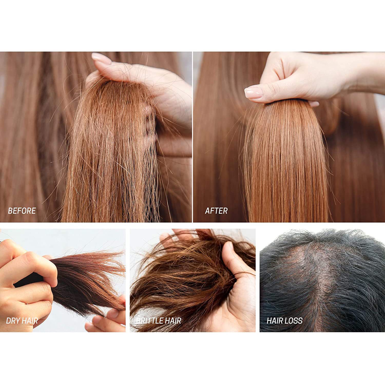 iBeaLee Hair Growth Serum Biotin Hair Loss Prevention Thinning Hair Treatment