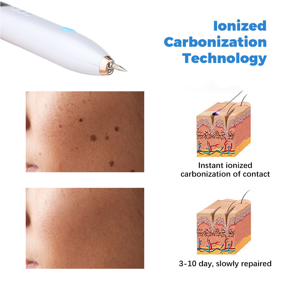 Laser Plasma Pen Mole Removal Dark Spot Skin Tag Tattoo Mole Wart Remover Pen