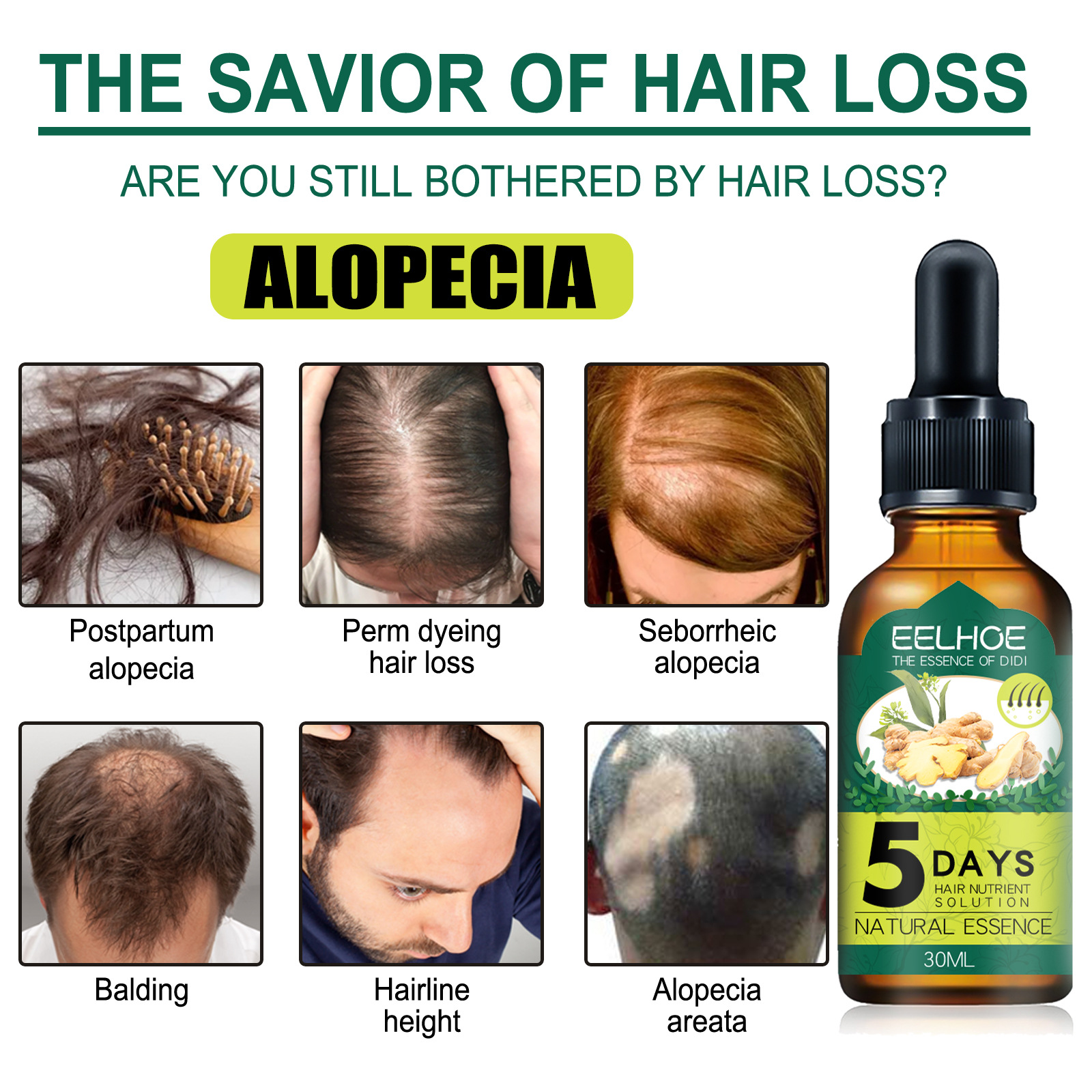 Ginger Hair Care Essential Oil Hair Growth Liquid Anti Hair Loss Serum 5 Days Nutural Solution Treat 30ml