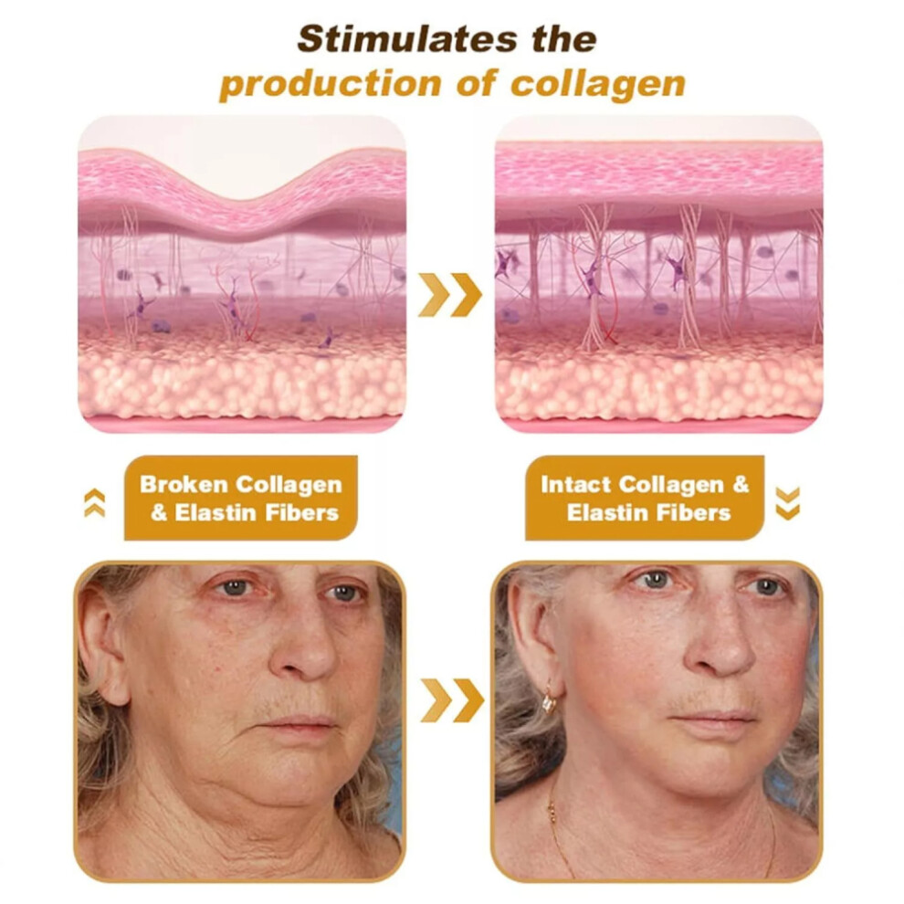 2X New Bee Venom Wrinkle Cream Bee Venom Skin Treatment Cream Anti-Wrinkle Firming Anti-Aging Moisturizing Lifting & Recovery for All Skin