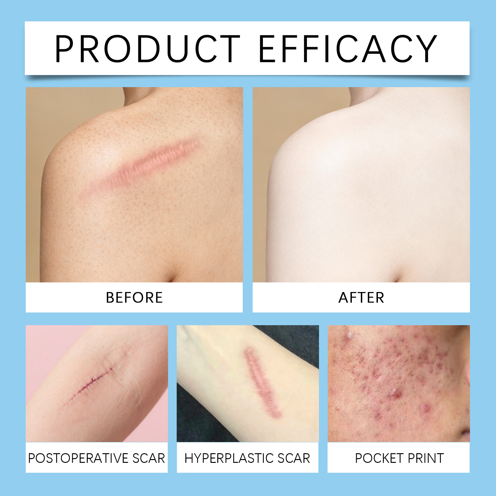 Skin Care Ointment Daily Moisturizing Smooth Tender Delicate Mild Care Body Skin External Use Lotion