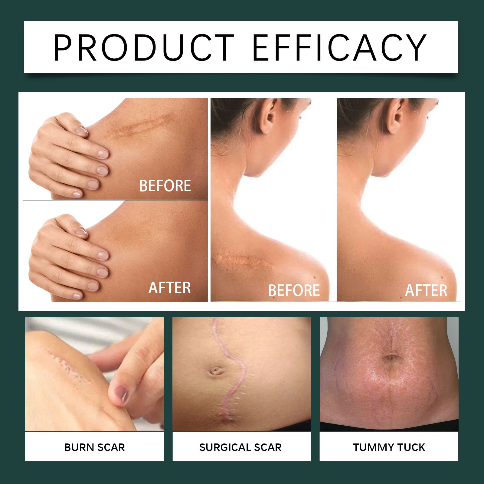Skin Care Patch Mild Nourish Protect Soft Elastic Hydrated Glossy Body Skin Daily Maintenance
