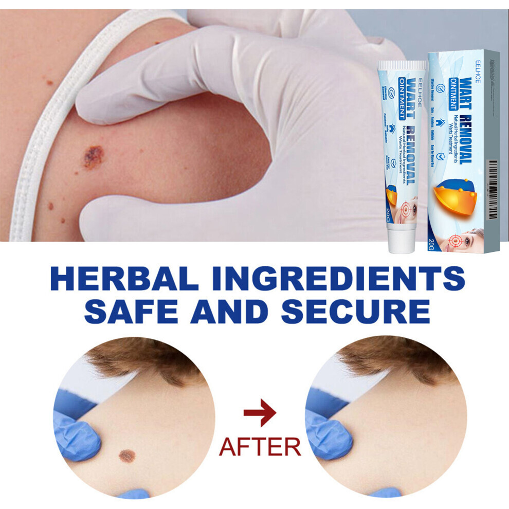 Wart Remover Cream 20g Fast Acting Gel Wart ACare Ointment for Face Hands Feet Body