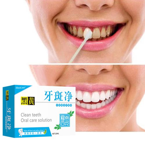 Clean Teeth Oral Care Solution Whiten Teeth Remove Plaque Stains Fresh Breath Oral Hygiene Dental Tools