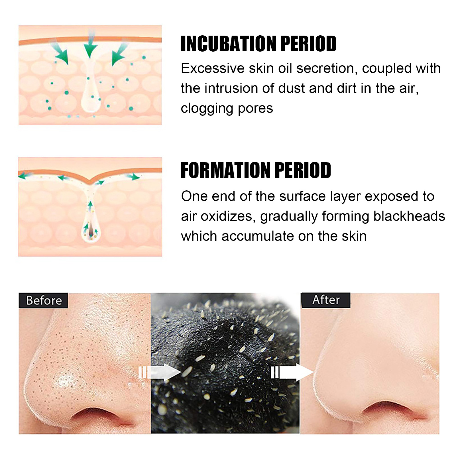 Blackhead Nose Patch Bamboo Charcoal To Remove Blackheads Clean  Pores Adsorb Oil And Dirt Nose Film Nose Stick