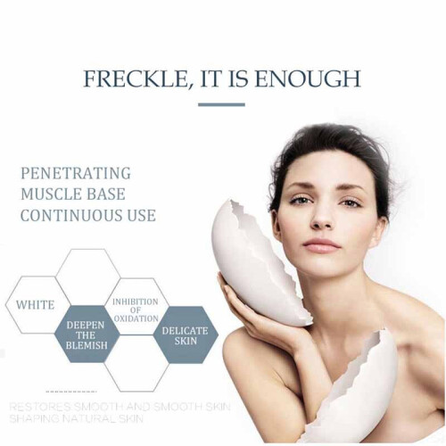 Whitening Freckle Cream Remove Melasma Acne Dark Spot Skin Care 20ml