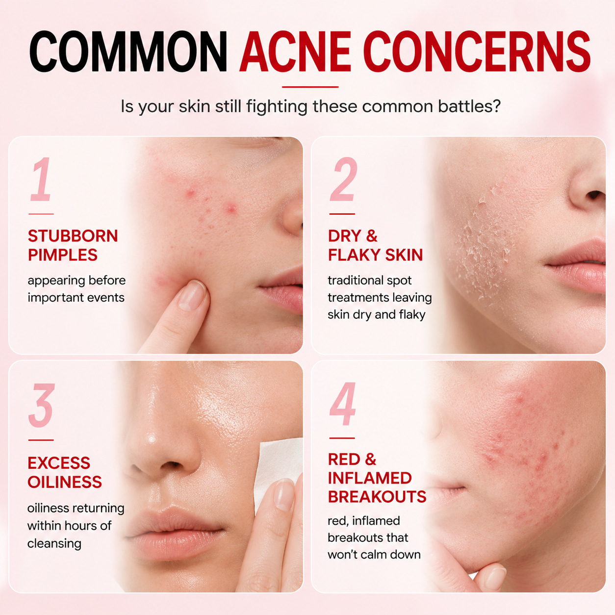 Overnight Blemish Repair Solution For Acne Prone Skin Soothing And Spot Treatment 20ml