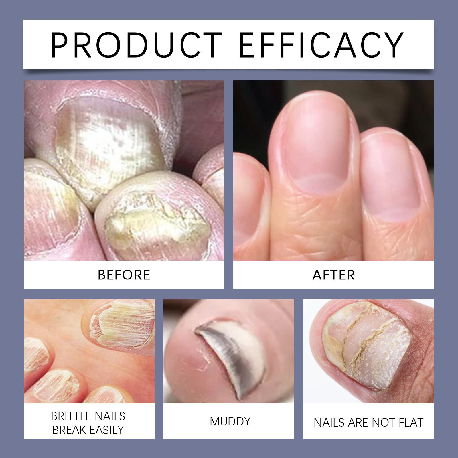 Nail Cleaning Spray Gentle Soothe Soften Cuticle Polish Nail Surface Bright Shine Daily Care