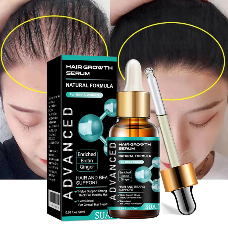 Hair Growth Serum Hair Essence Hair Nourishing Solution Liquid Treatment Anti Hair Loss Hair Care Dense