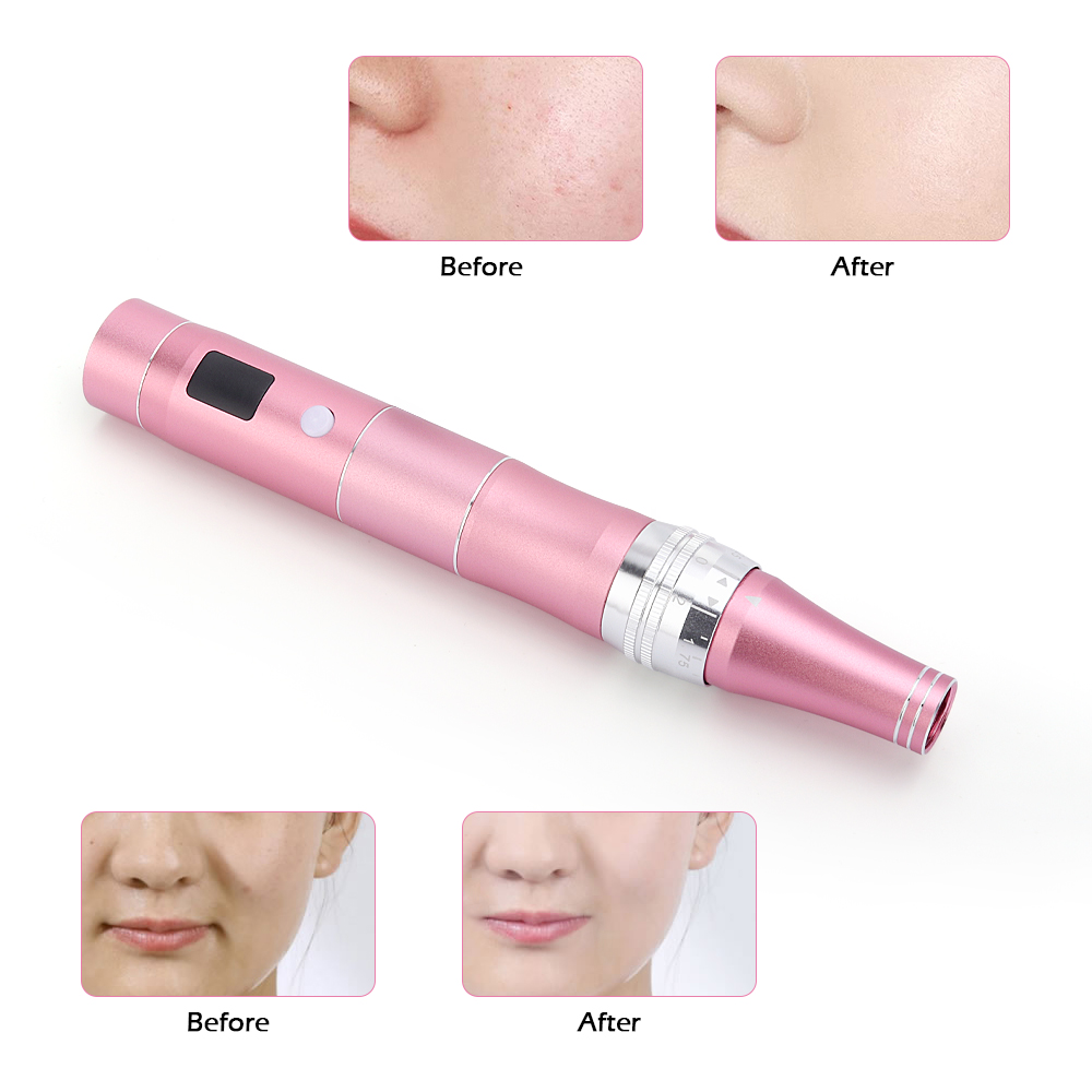 (Gold) Microneedling Pen Wireless Professional Electric Derma Pen Needles Auto Home Mts Tattoo Pen Skin Care Beauty Tool Kit Anti-Aging Mesotherapy Traetment.