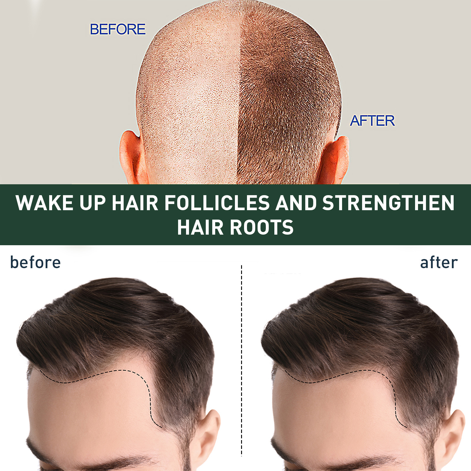Ginger Hair Growth Serum 7 Days Prevent Hair Loss Essential Oil Fast Beard Hairline Growing Scalp Treatment for Women Men 30ml