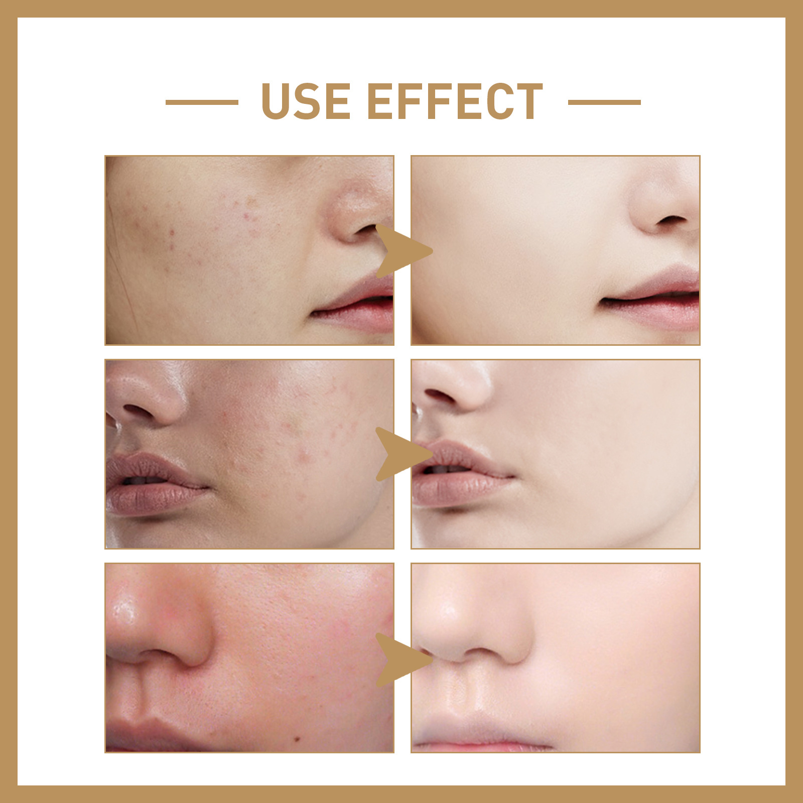 Rice Toner Deeply Moisturizing Brightening Restore Skin Texture Shrink Pores Nourishing Dryness Anti Aging Hydrate 150ml