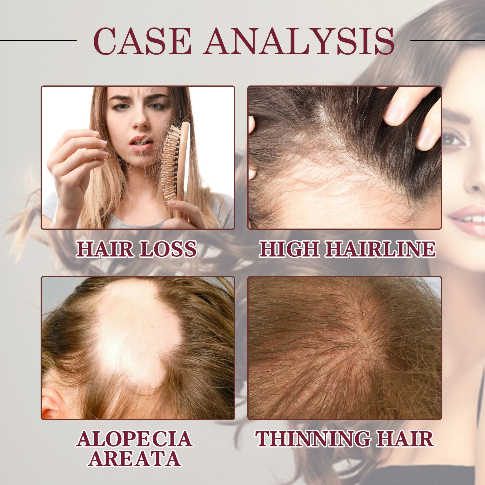 Hair Growth Serum Spray Prevent Hair Loss Scalp Treatment Improve Alopecia Strengthening Anti Dry Frizz Red Onion Essential Oil Hair Care Oil