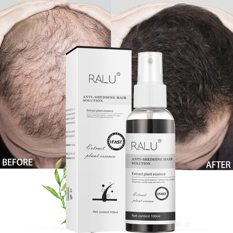 Blusoms Anti-Shedding Hair Spray Shedding Hair Solution Natural Herbal Hair Growth Spray Hair Oil For Hair Growth Gift for Hair  Moisturizing 100ml