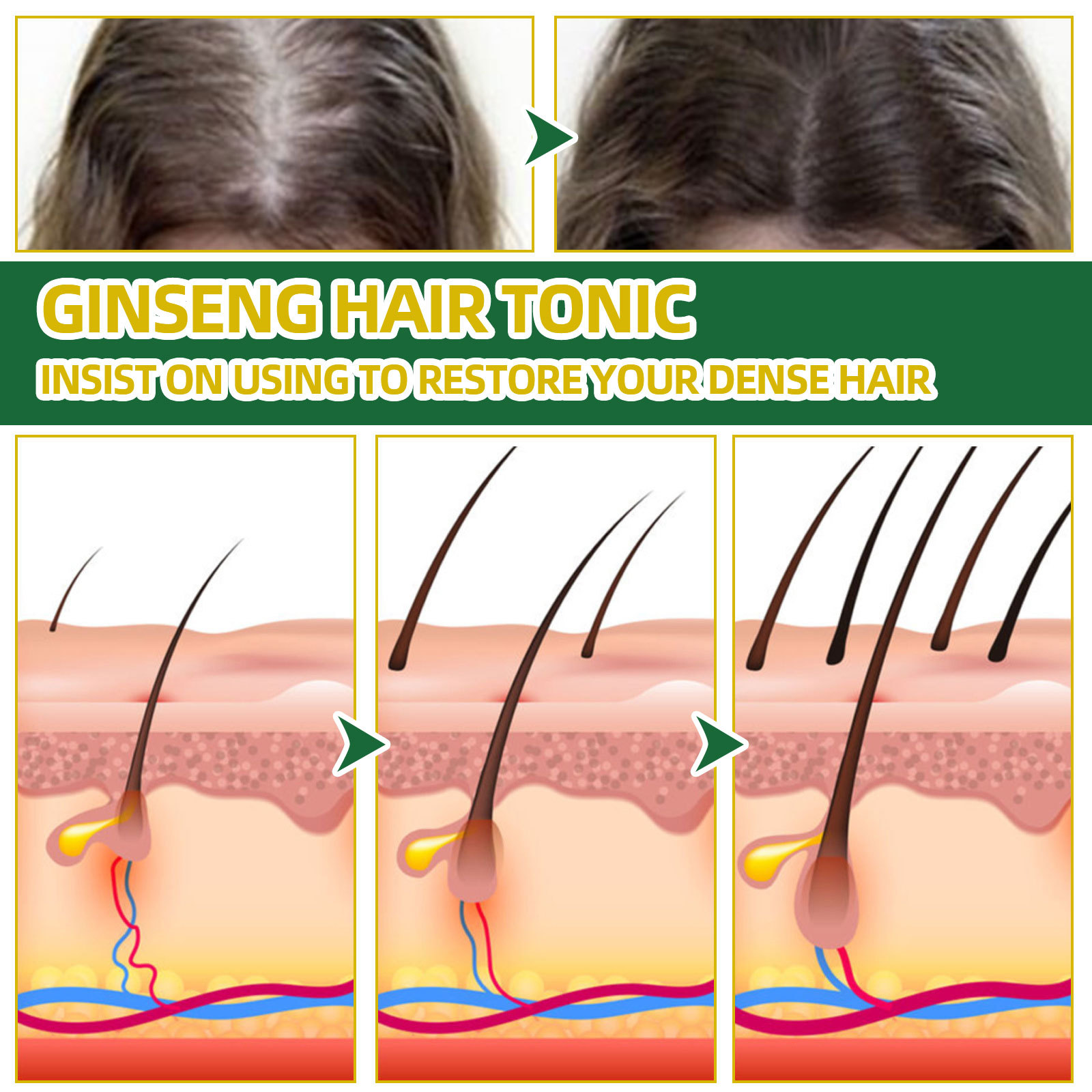 Ginseng Hair Growth Serum Oil With Biotin Essential Liquid Strengthen Hair Root Nourishes Hair Repairing Nourish Scalp Strengthen Roots Men Women 100ml